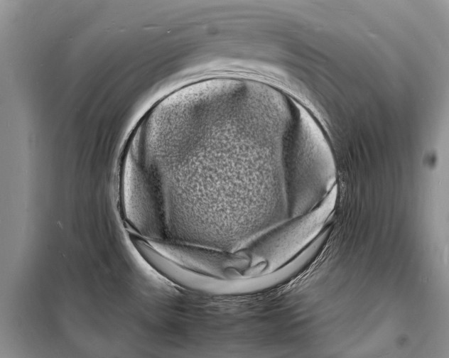 X0000098181531200805151128