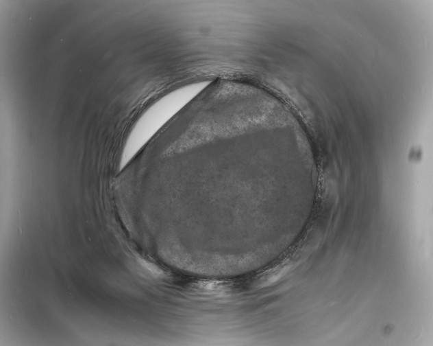 X0000098180117200805221546