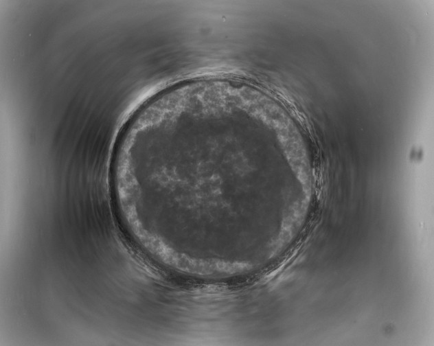 X0000098180196200805221545