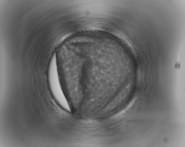 X0000098180785200805221536