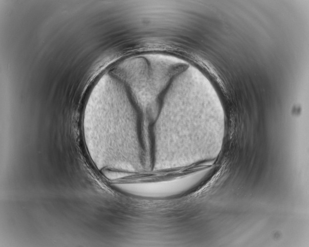 X0000098180786200805221536