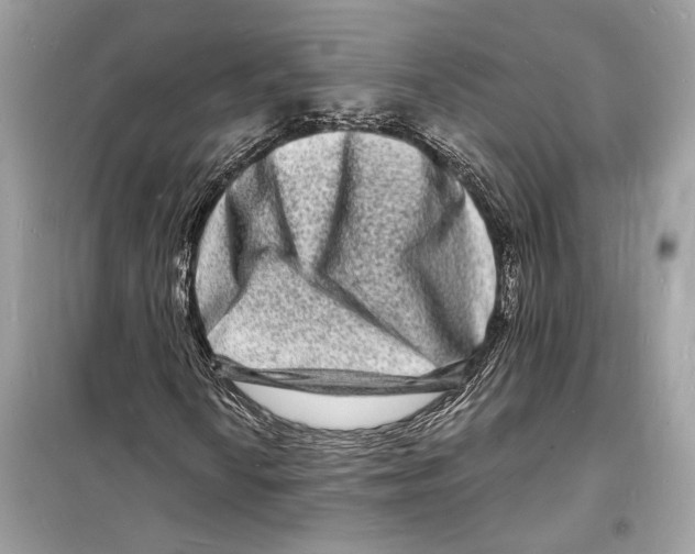 X0000098181010200805221532