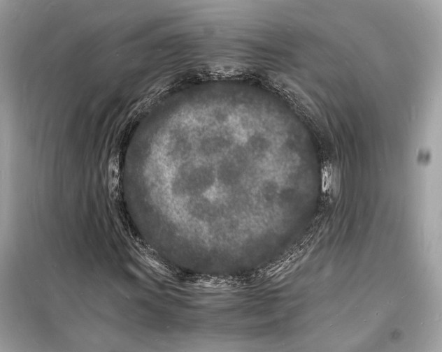 X0000098181011200805221532