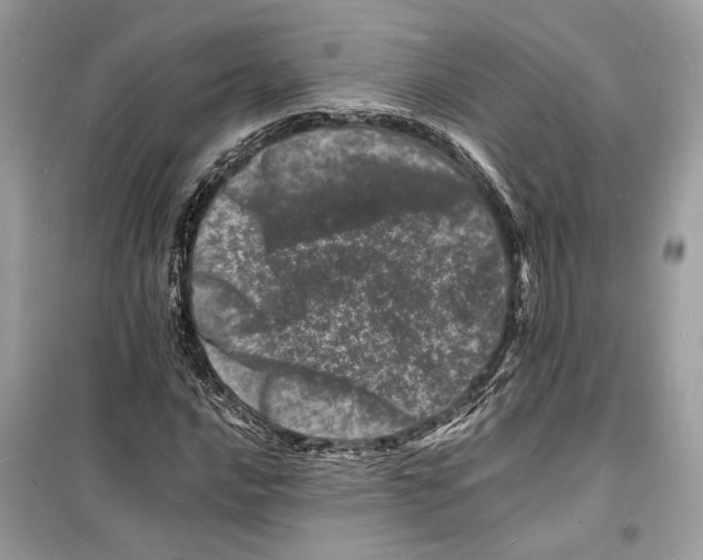 X0000098181016200805221532