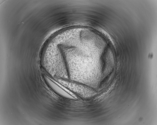 X0000098181019200805221533