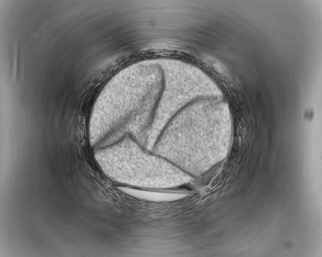 X0000098181062200805221532