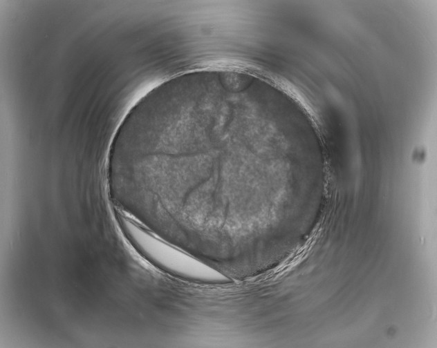 X0000098181087200805221532