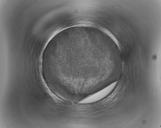 X0000098181099200805221532