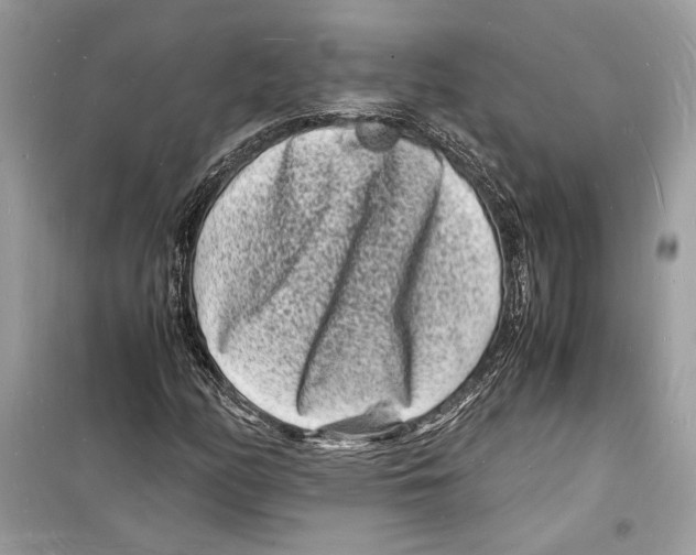 X0000098181158200805221531