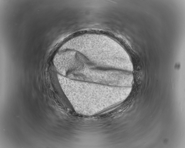 X0000098181159200805221531