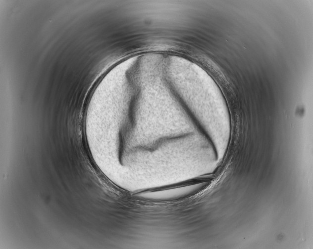 X0000098181178200805221530