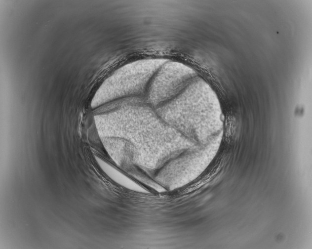 X0000098181202200805221529