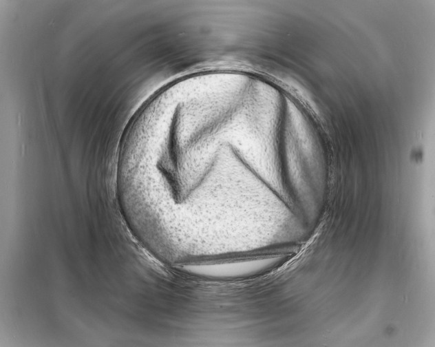 X0000098181228200805221530