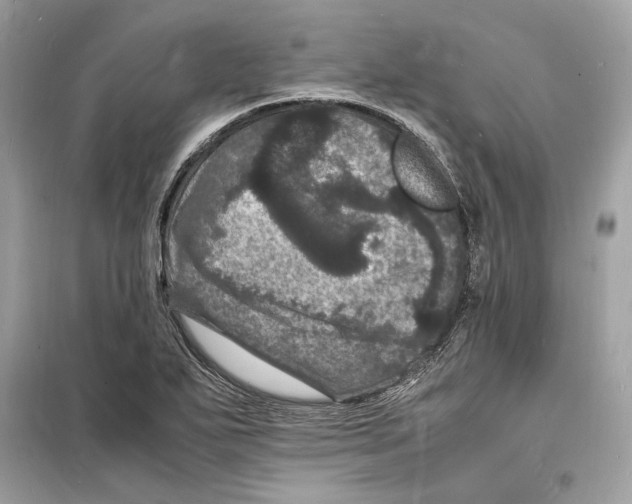 X0000098181271200805221529