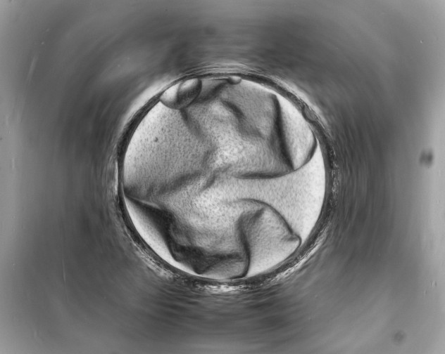 X0000098181317200805221528