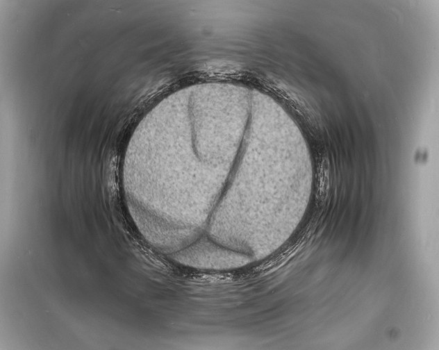 X0000098181346200805221528