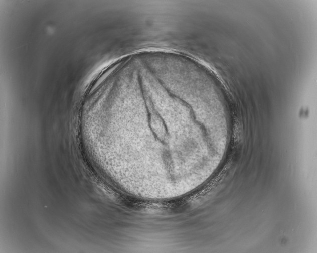 X0000098181359200805221528