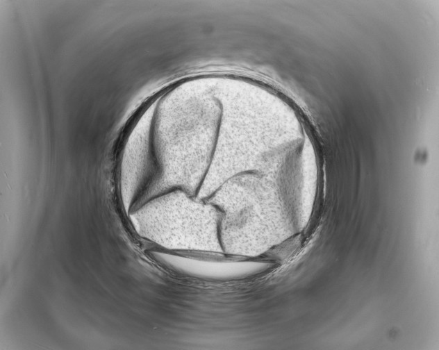 X0000098181501200805221526