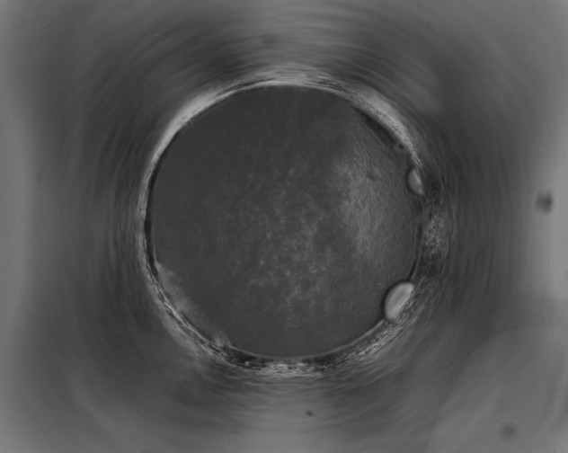 X0000098191146200804241238