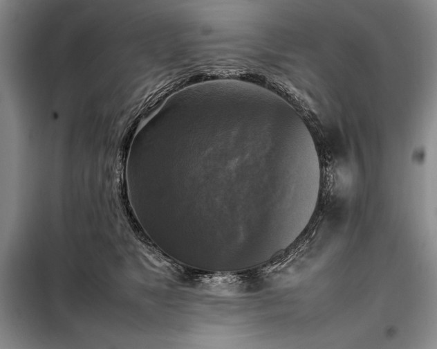 X0000098190517200805011126