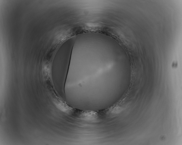 X0000098190576200805011126