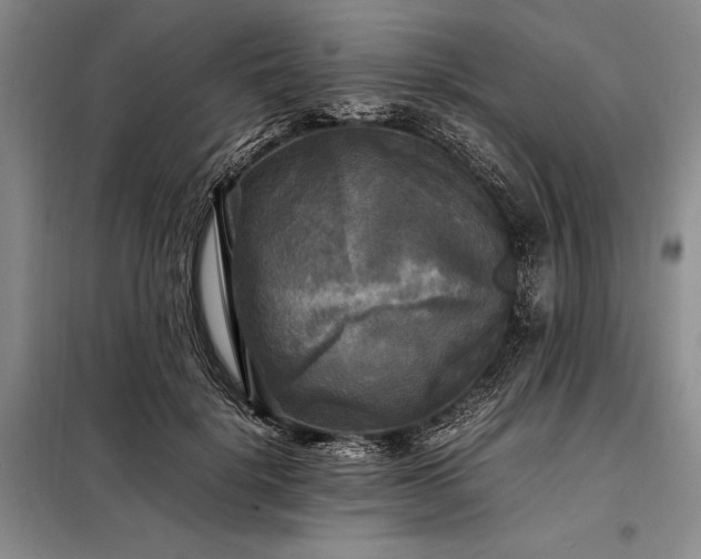 X0000098190652200805011124