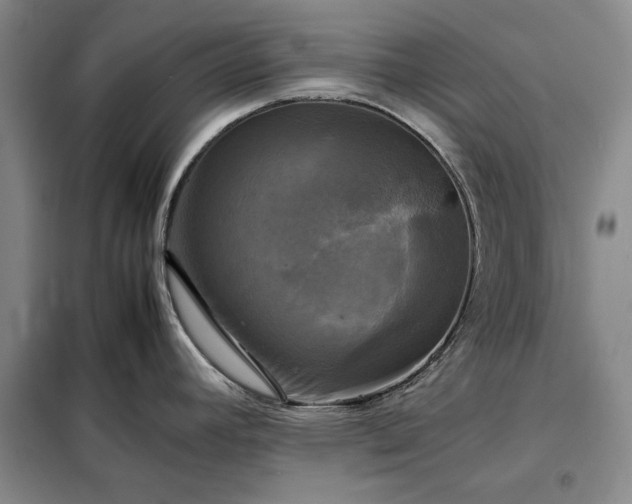 X0000098191392200805011114