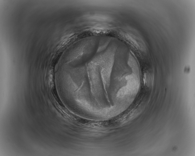 X0000098191396200805011113