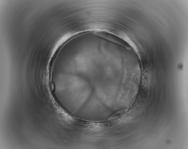 X0000098191096200805081042