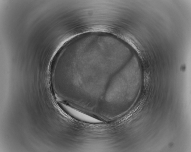X0000098191116200805081041