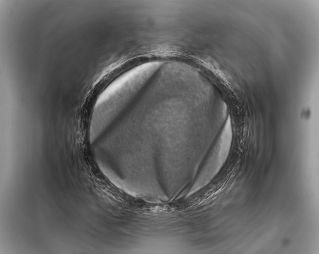 X0000098191160200805081041