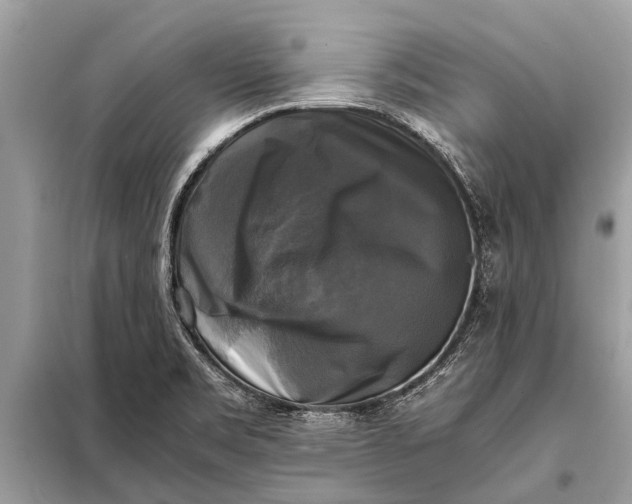 X0000098191469200805081036