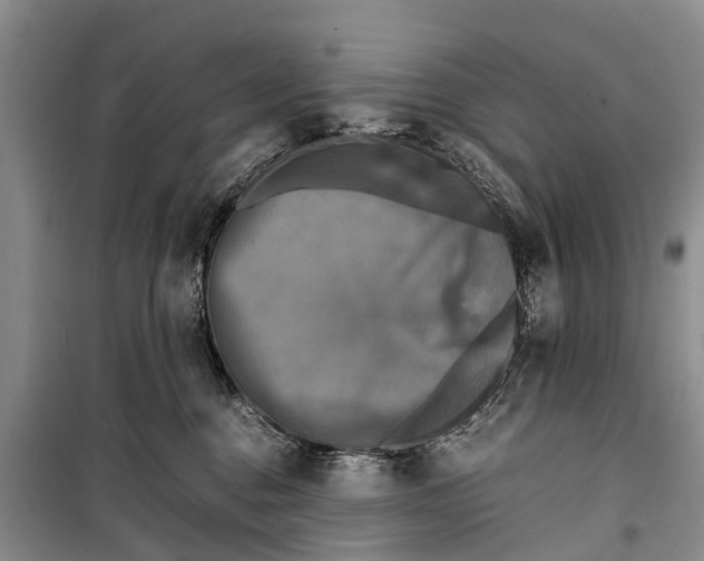 X0000098190376200805151211
