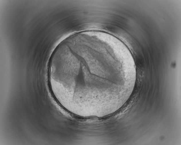 X0000098191142200805151159