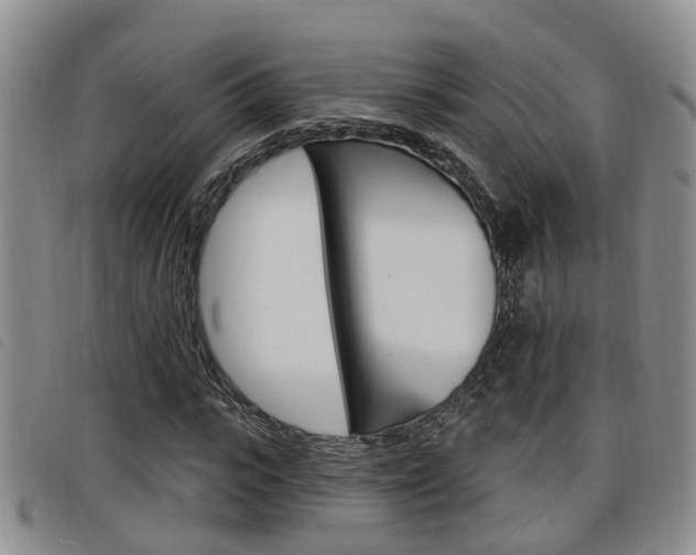 X0000098200919200804241035