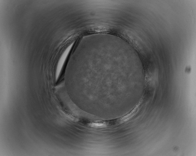 X0000098200170200805011155