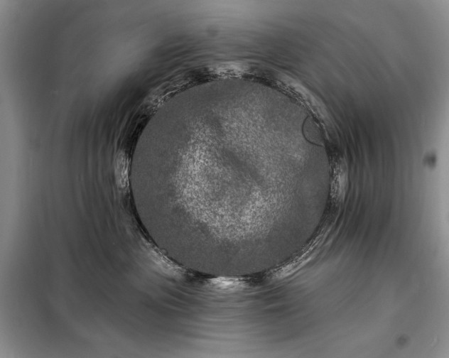 X0000098200477200805011151