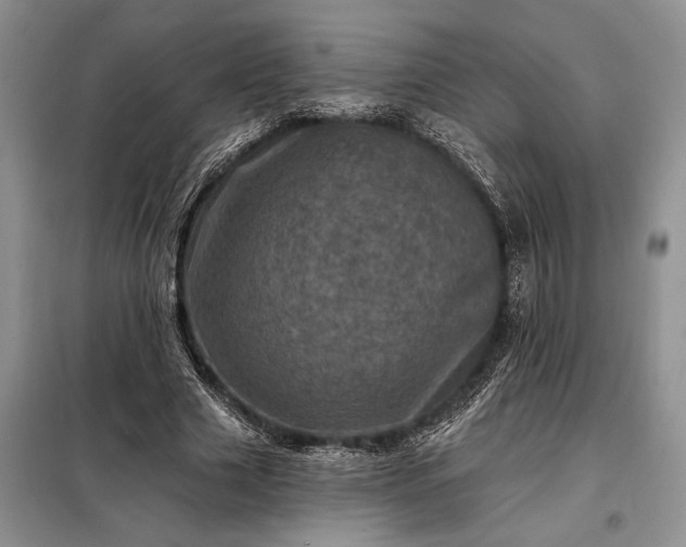X0000098200633200805011147