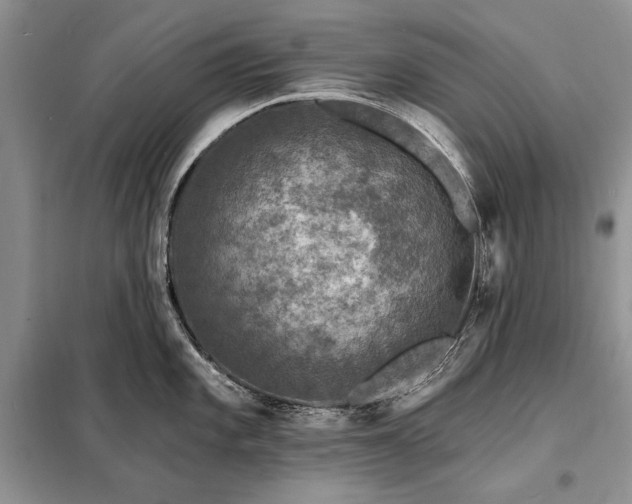 X0000098201101200805011141