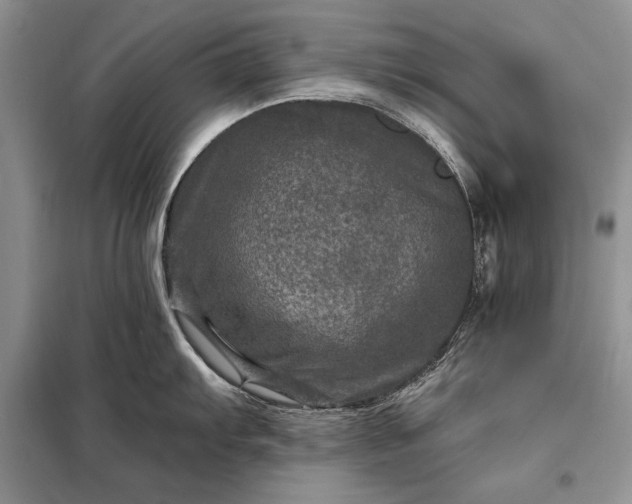 X0000098201103200805011141