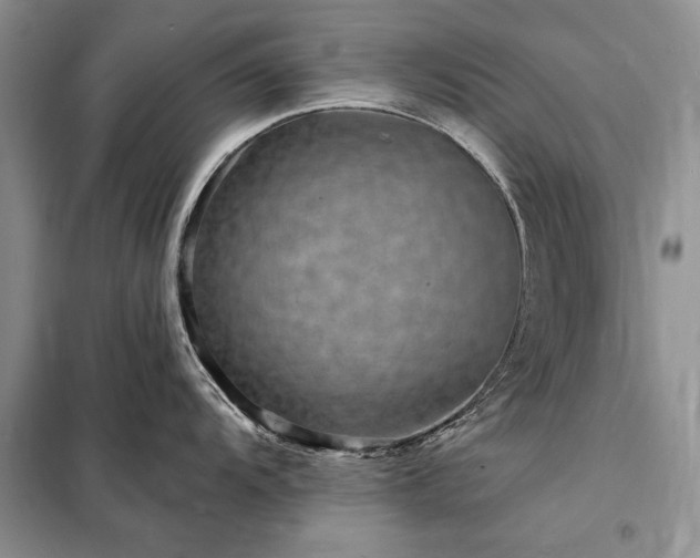 X0000098201104200805011141