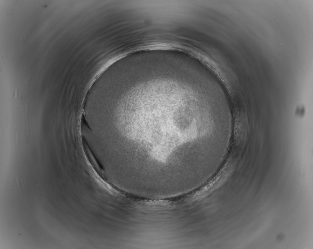 X0000098201417200805011136