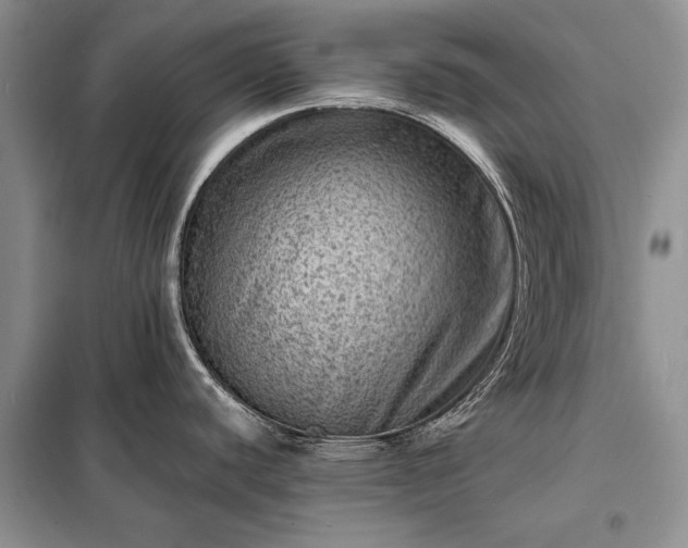X0000098201440200805011136