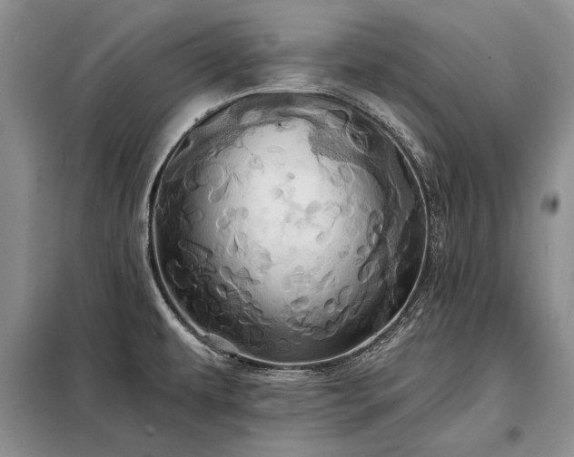 X0000098201479200805011135