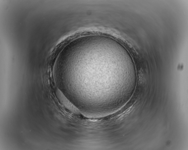 X0000098201494200805011135