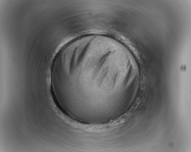 X0000098200011200805081122