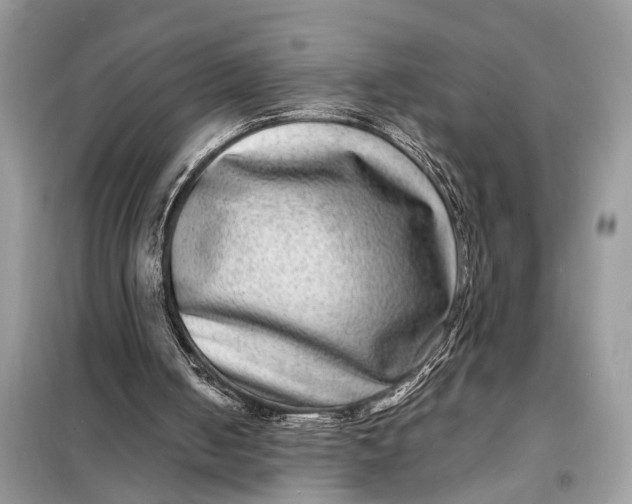 X0000098200050200805081121
