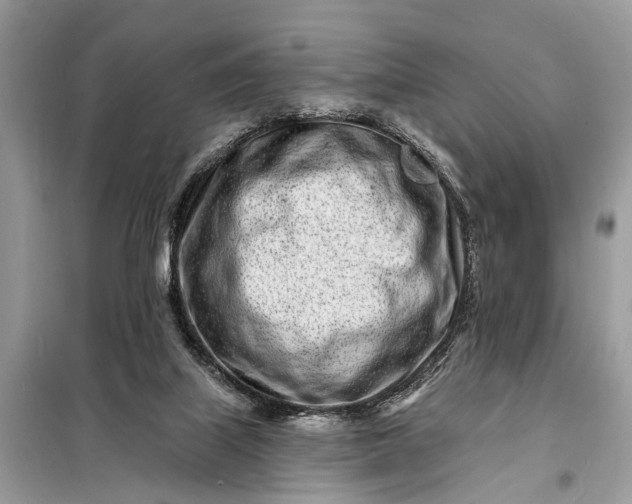 X0000098200067200805081121