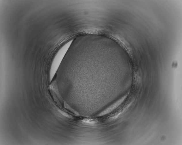 X0000098200117200805081120