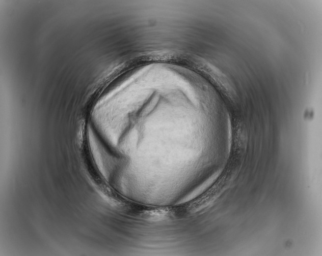 X0000098200118200805081120